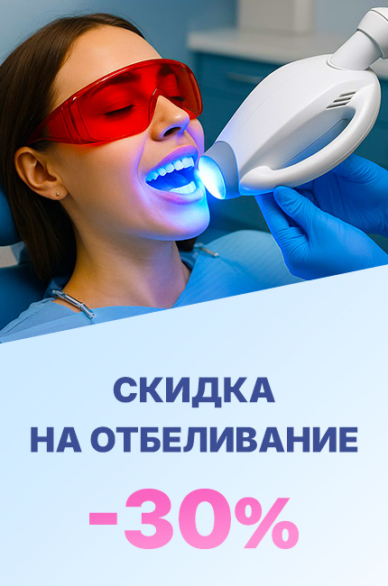 Скидка на отбеливание - 30%