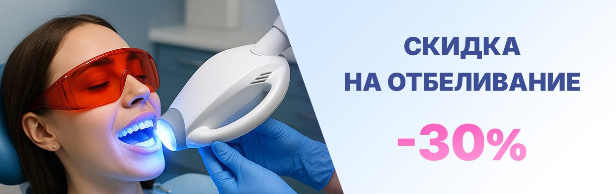 Скидка на отбеливание - 30%